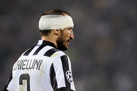 Giorgio Chiellini (Juve)
